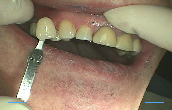 Cosmetic patient case before the procedure