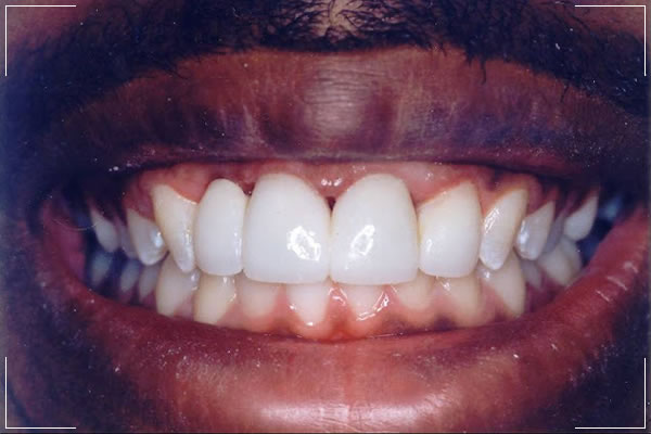 man smiling