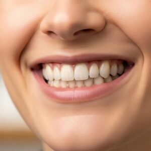 close-up-of-a-smiling-patient-displaying-the-aesthetic-improvements-from-dental-bonding